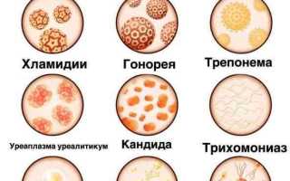 Все болезни связанные с урологией