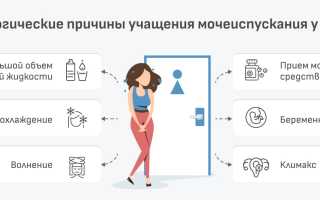 Частые безболезненные мочеиспускания: стоит ли женщине беспокоиться