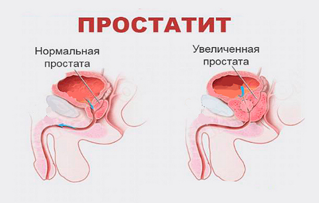 урологический пластырь мыться можно