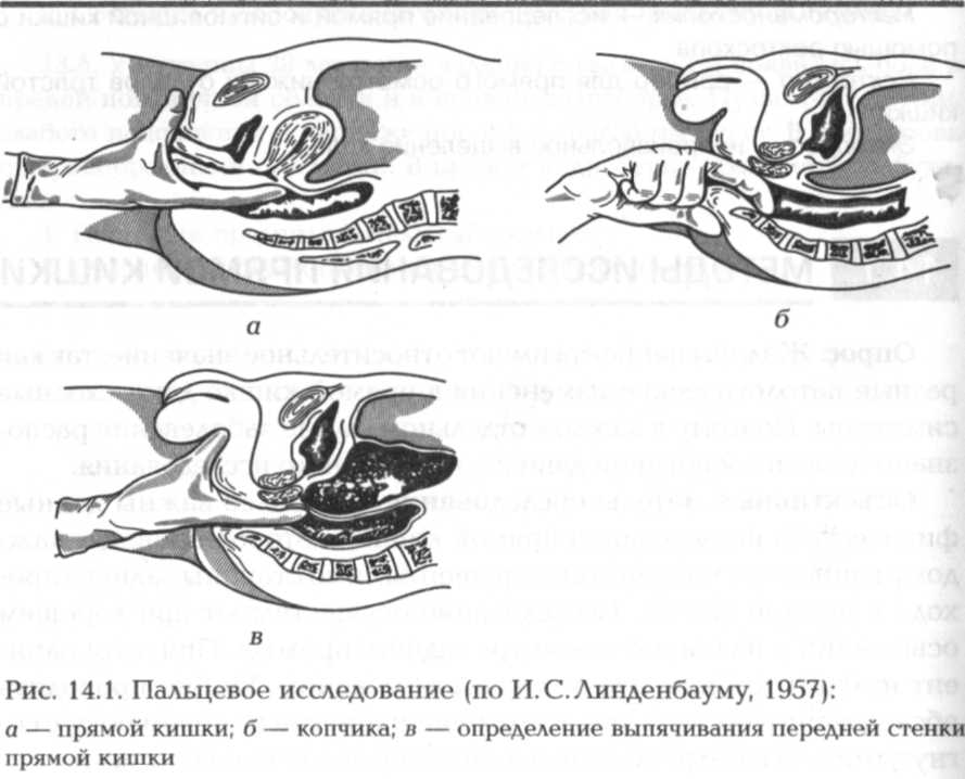 Методы исследования урологических заболеваниях